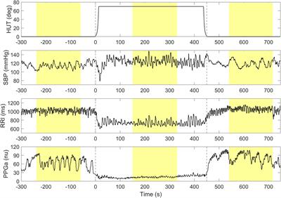 Sickle Cell Disease Subjects Have a Distinct Abnormal Autonomic Phenotype Characterized by Peripheral Vasoconstriction With Blunted Cardiac Response to Head-Up Tilt